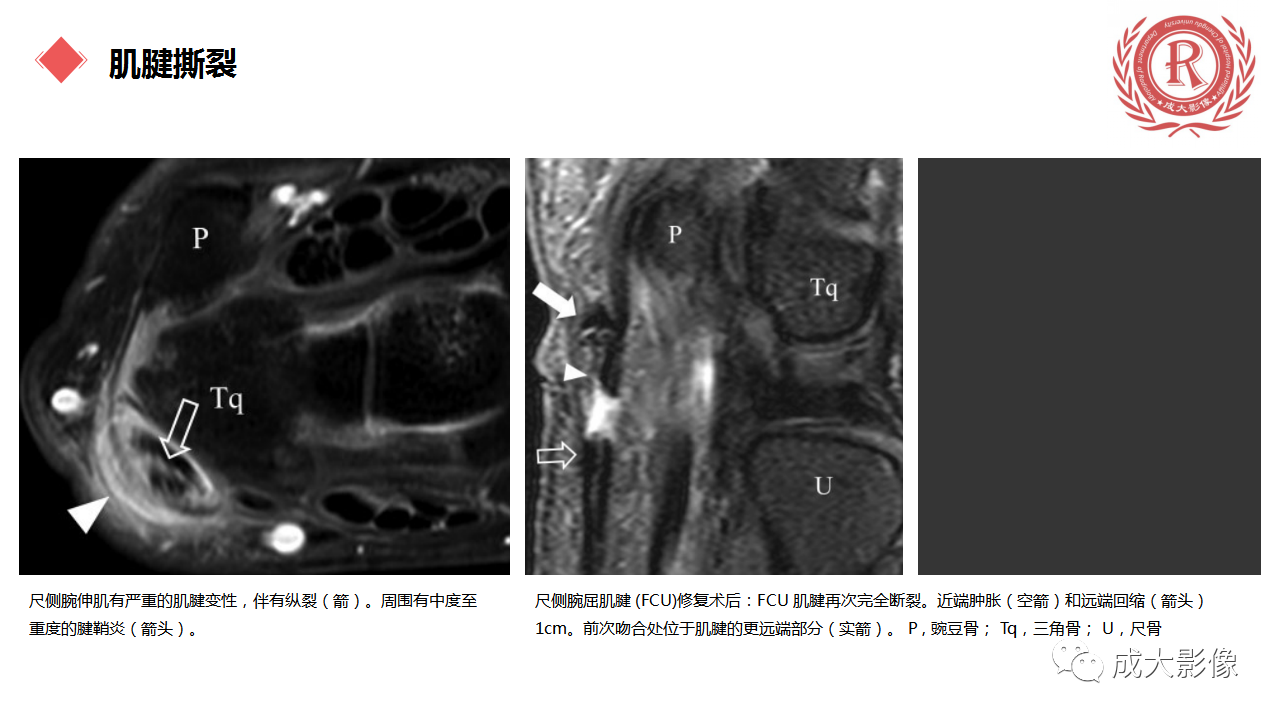 1cdc099cba17fc5a1b8cf54354f6f9bc.png