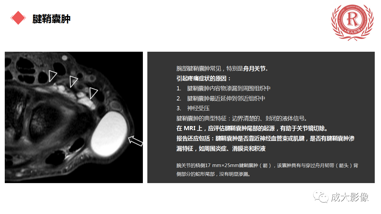 4399ddea1e025d6fd6c9ffa83a8d252b.png