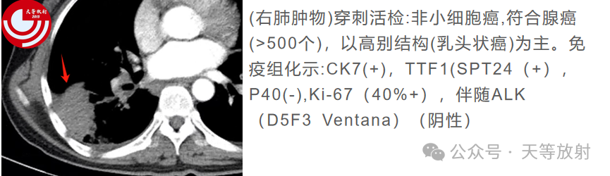 0bba60b0e65b6f81f197bb18364e12c0.png