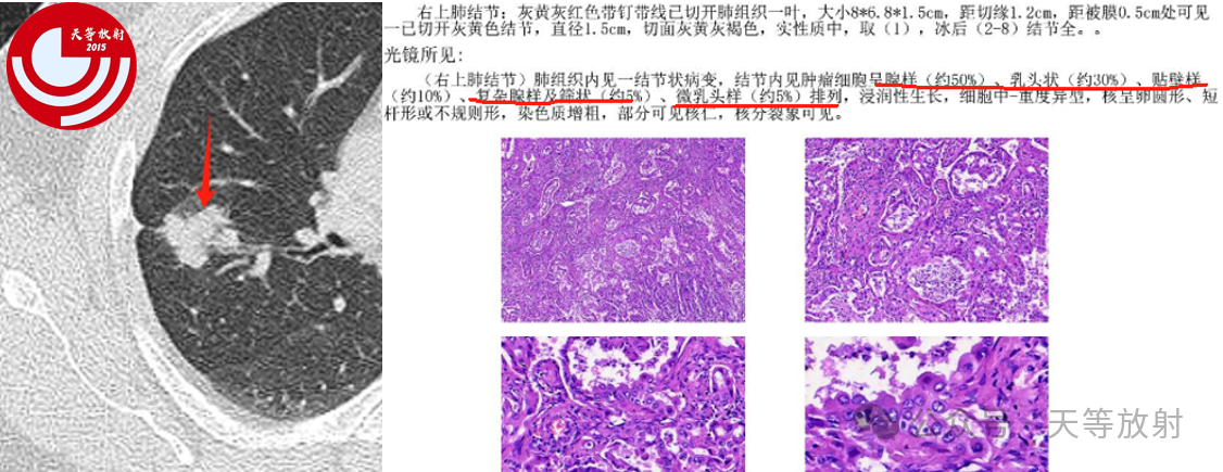 b89dcc68e3a993fbfa3000beeda6f615.png