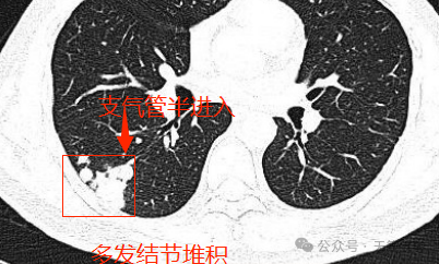 08868eea14fb1240cc79811c16d4429c.png