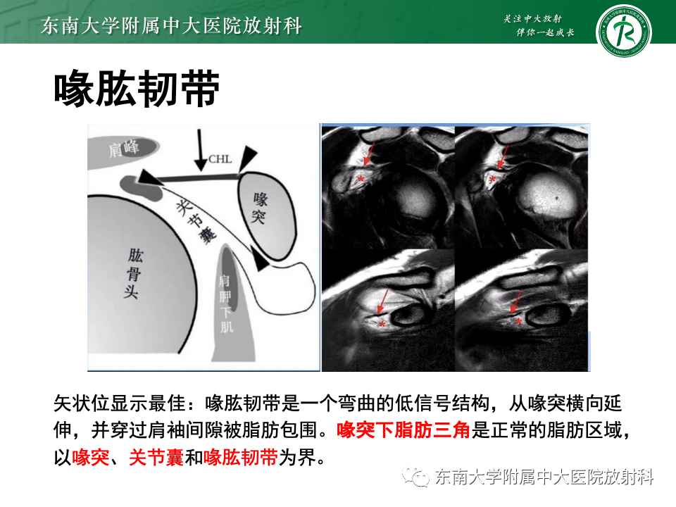 fa73c4e49a9515cb50cb1b292c42f13b.png