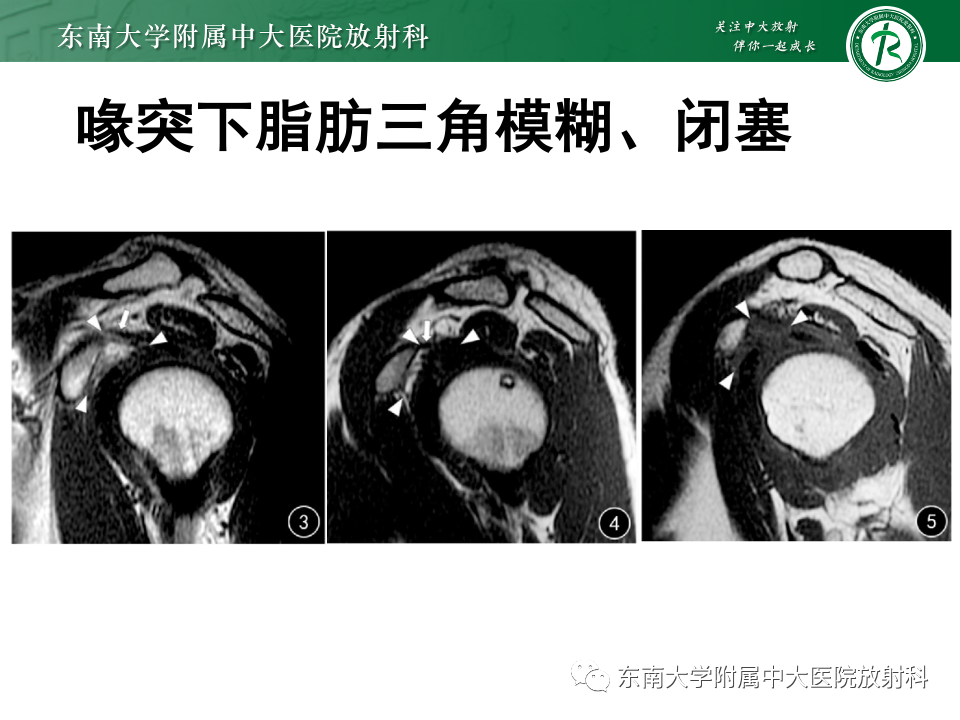 dcbf7509dfac46391ed12dd044051fb6.png