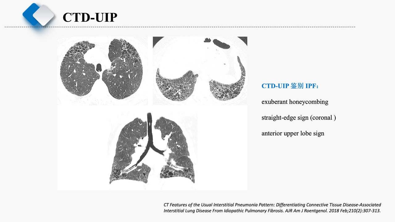 09cac954e9fa1885d7ca7d642ebddf9a.png