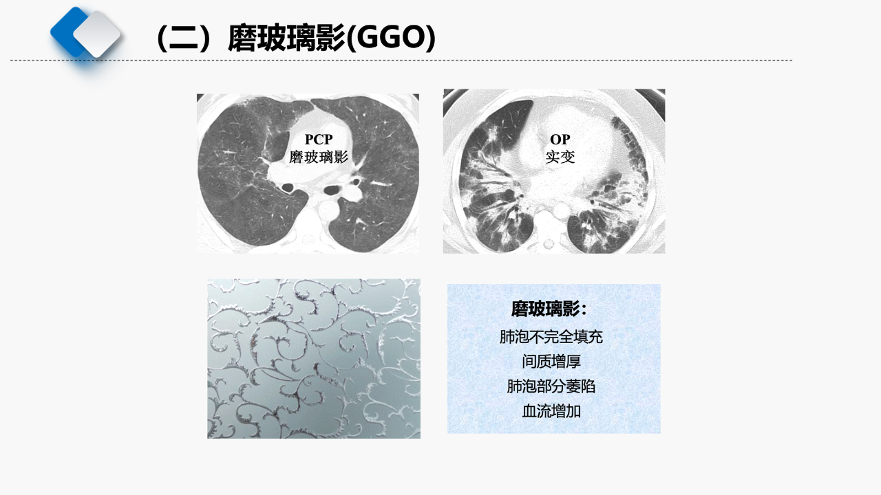 384fe70755a2d9d628e596e0e4e1cb8e.png