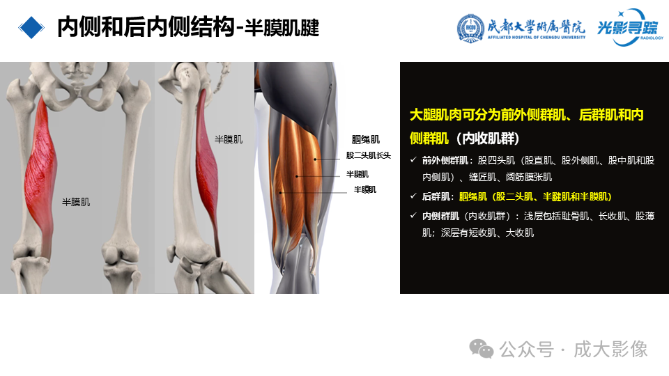 cbea94794c12c53ac293c7c2e9ee34dd.png