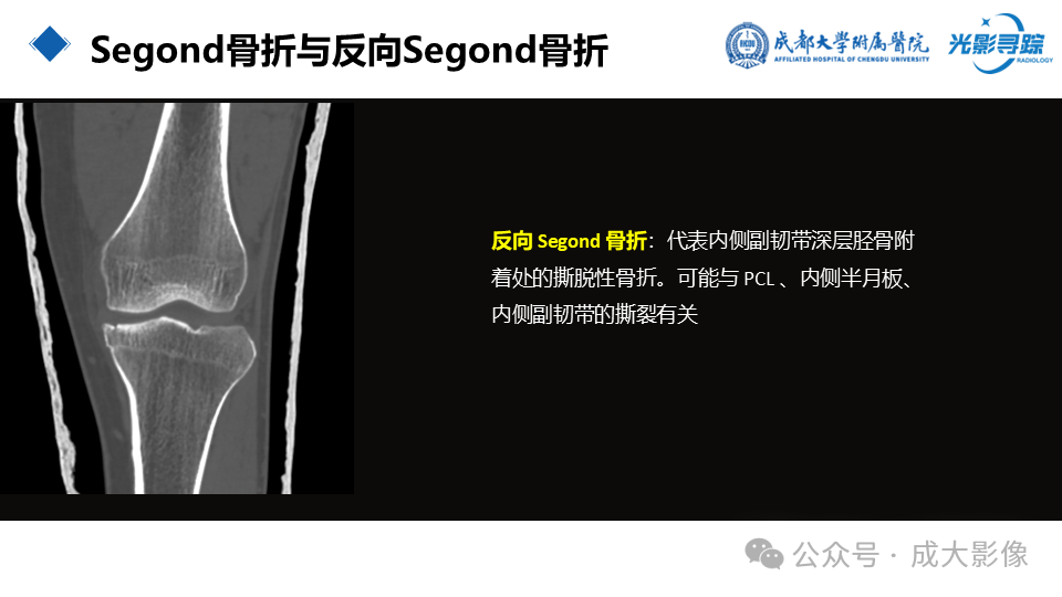 b4549099b0475dd7a9063584ab36fbb5.png