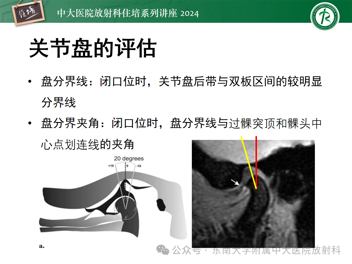 6b8a21c165cd397d28977019d84fdf93.png