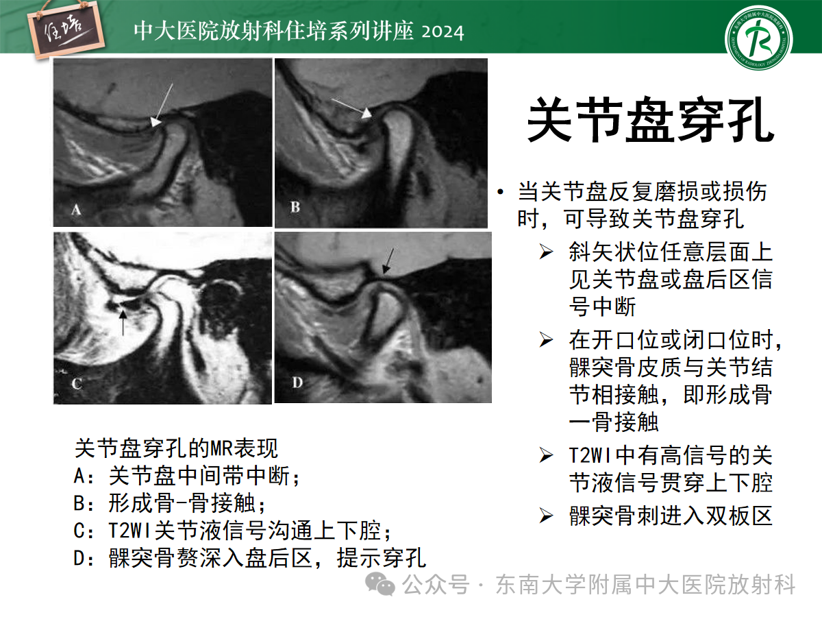 740a15ecd4a3049dee336afe63c15bfb.png
