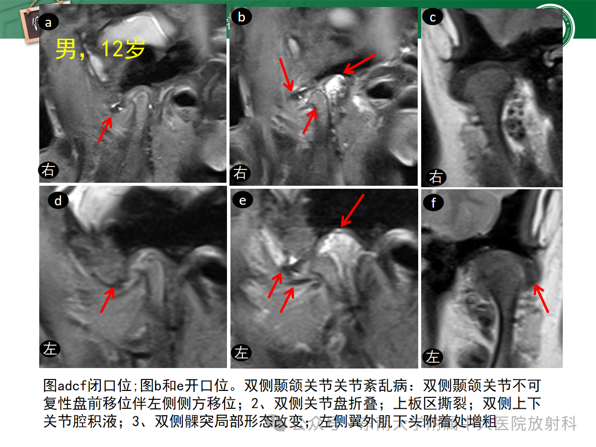 2f2b33be8cb9c57fcc4bfee8445dccdf.png