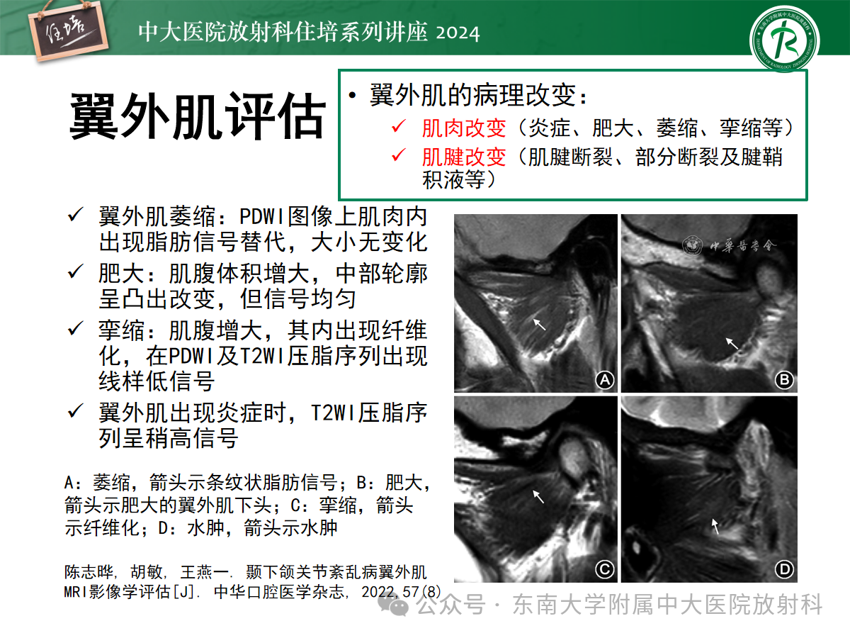 aafd0317f75febb4c92ceffcebbd905f.png
