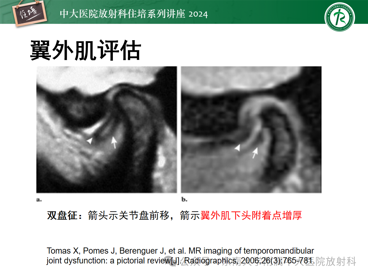 ec64a44c355b461d5bcc815b349ea3f7.png