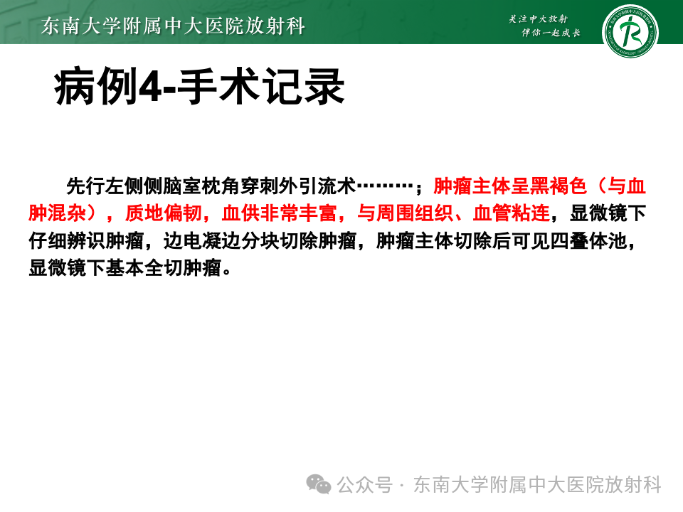 5d440607c39cdb30981e6c4d303a98cc.png