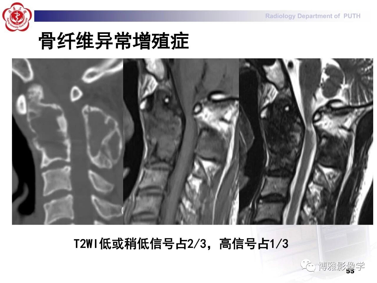 cea83afdec2e4b0b5d91a7a9e2d4688a.jpg