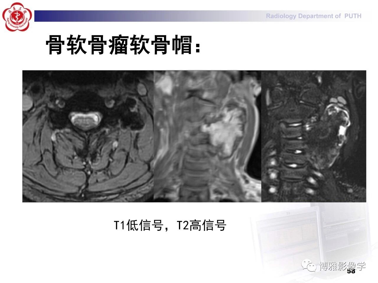 c87a84f0bf7d460eb9b0b41bccc55542.jpg