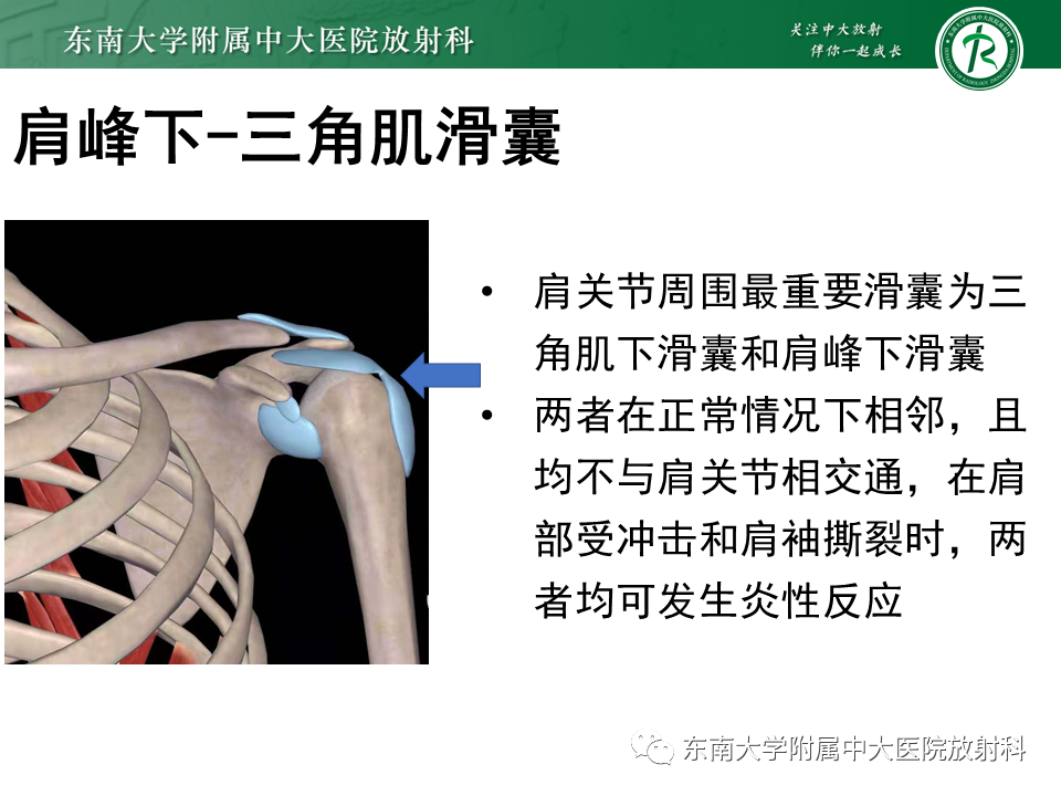 acc2087d1dbd5f3a17b1ce8de795660b.png