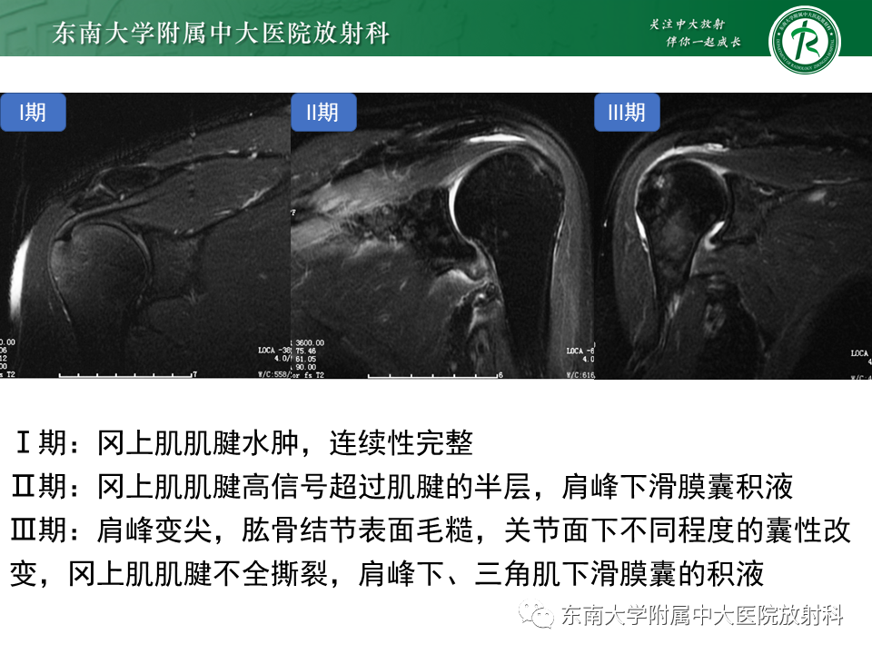 b8c43319b50a80a60c0c0d377e663155.png