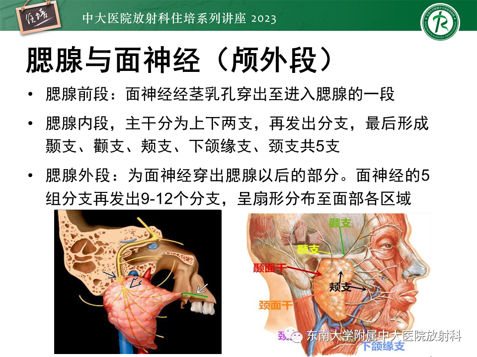 944df66e5dc181fd4cf1ccbc3eee0dfb.png