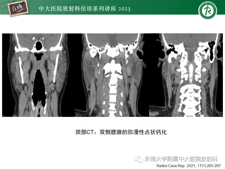 e97414a1670d0b88d10aea01d2936c36.png