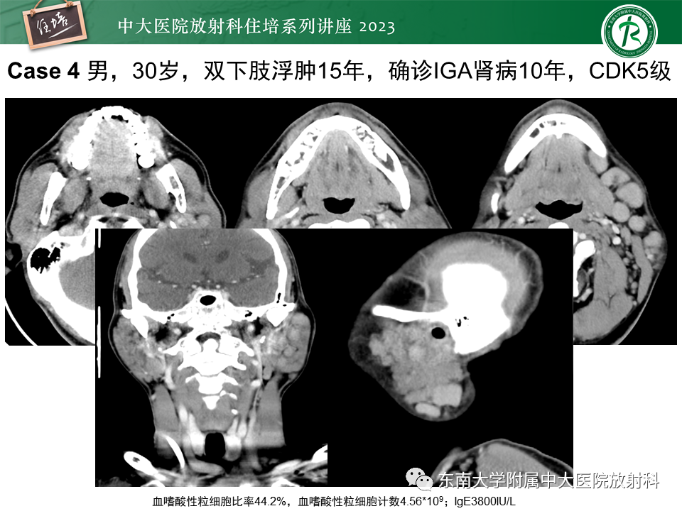 8a185a6dfbe3996ae60dec639a02aae1.png