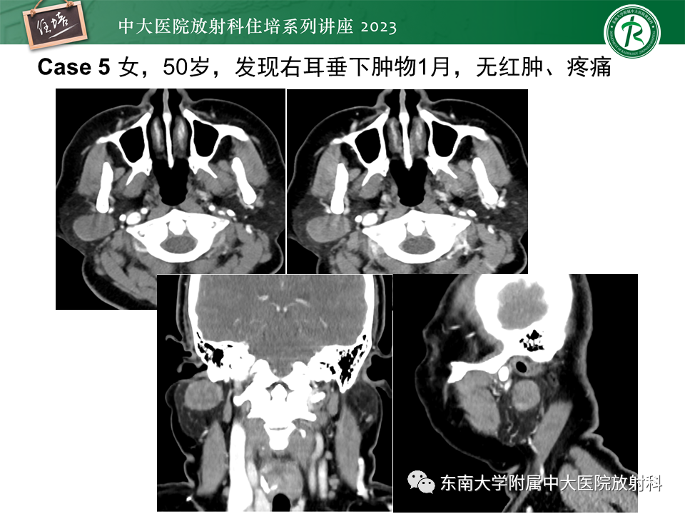 6b9f110e3081e84e434fccac8ad5d9f8.png