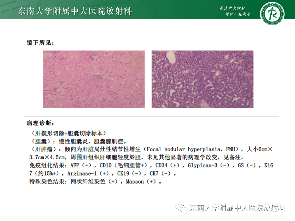 7ab9c288fad0fc19c989b7872bd5192b.png