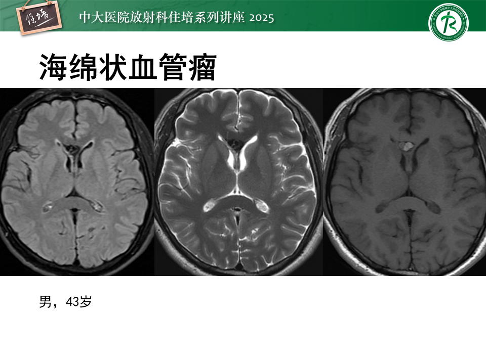 30f304f045572965a01700b5beffe28b.png