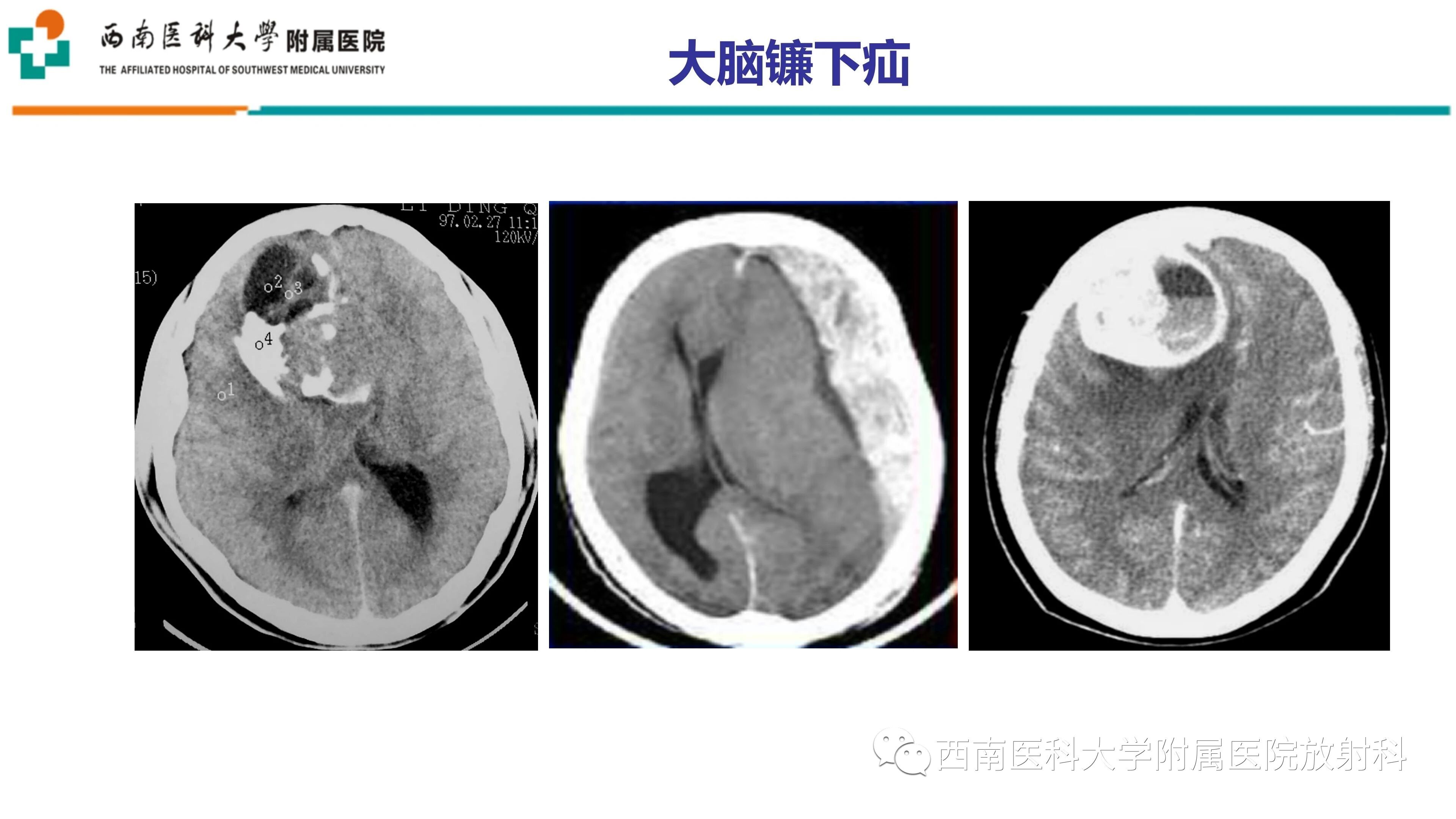 d985974dd828083ac2239ab77ddc49e9.jpg