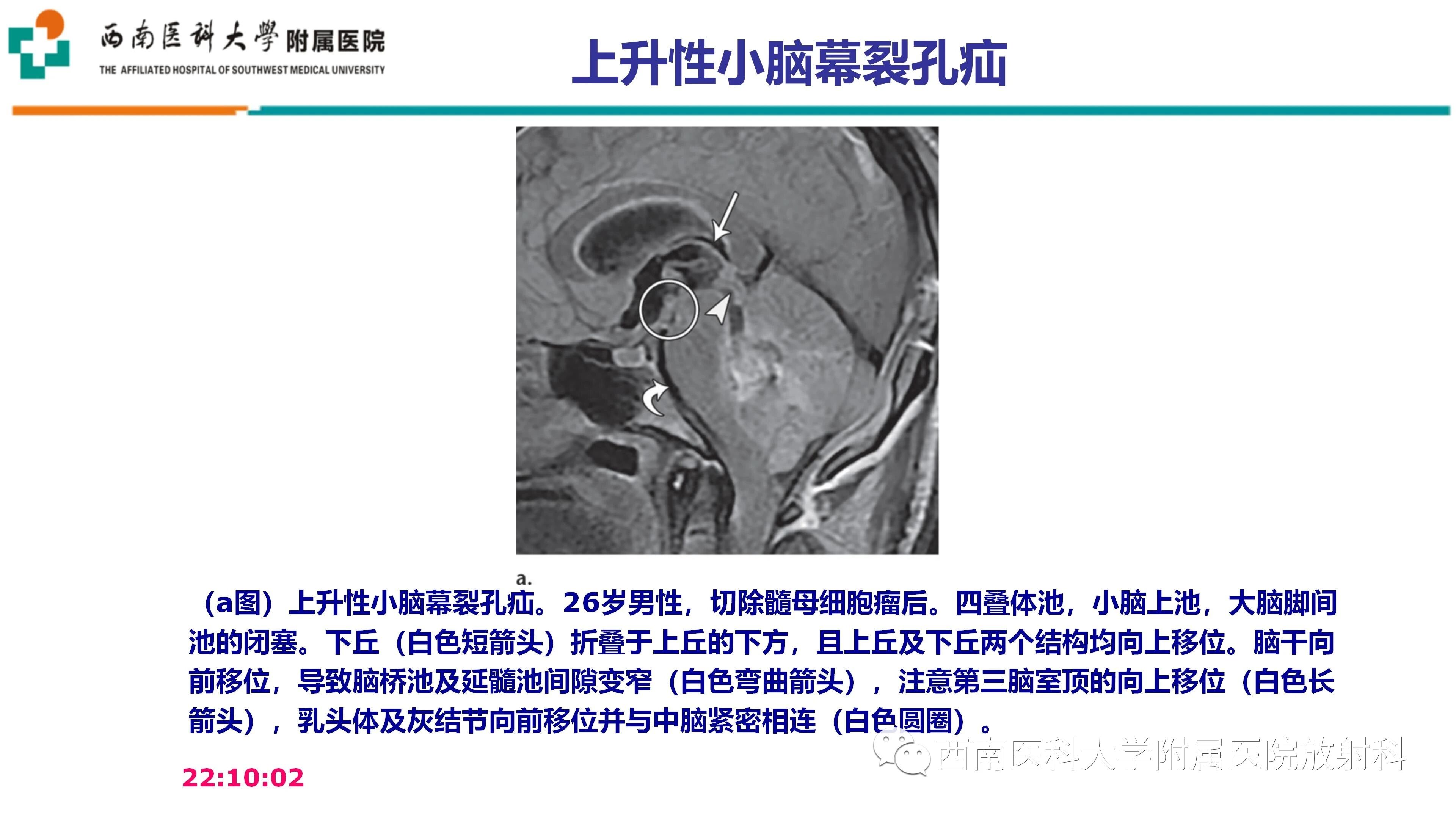 b7c43d96fb9a69f37361fcd3a0cb3057.jpg