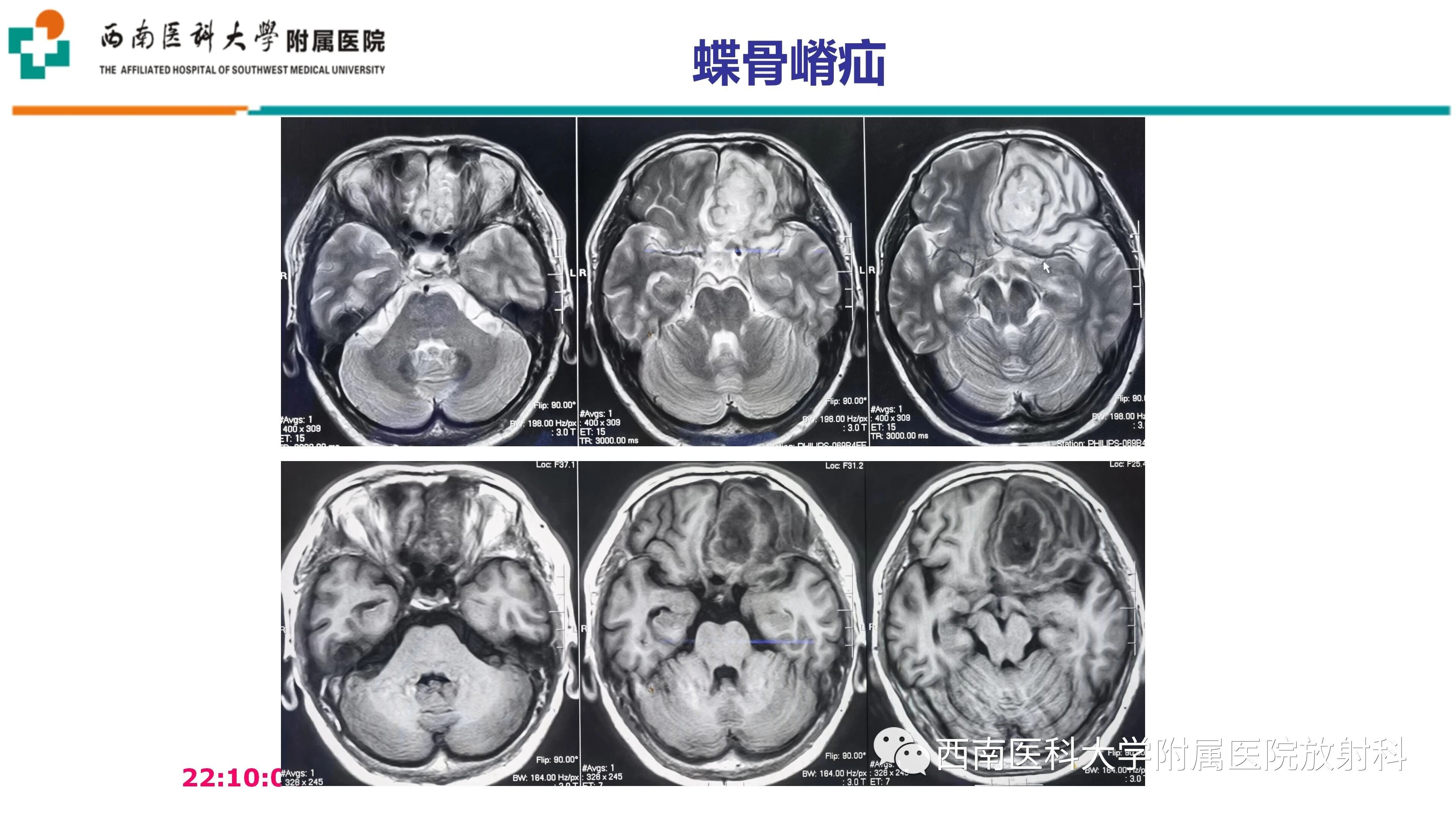 dbbca4f542657f1a76e96c2a8dea35f1.jpg