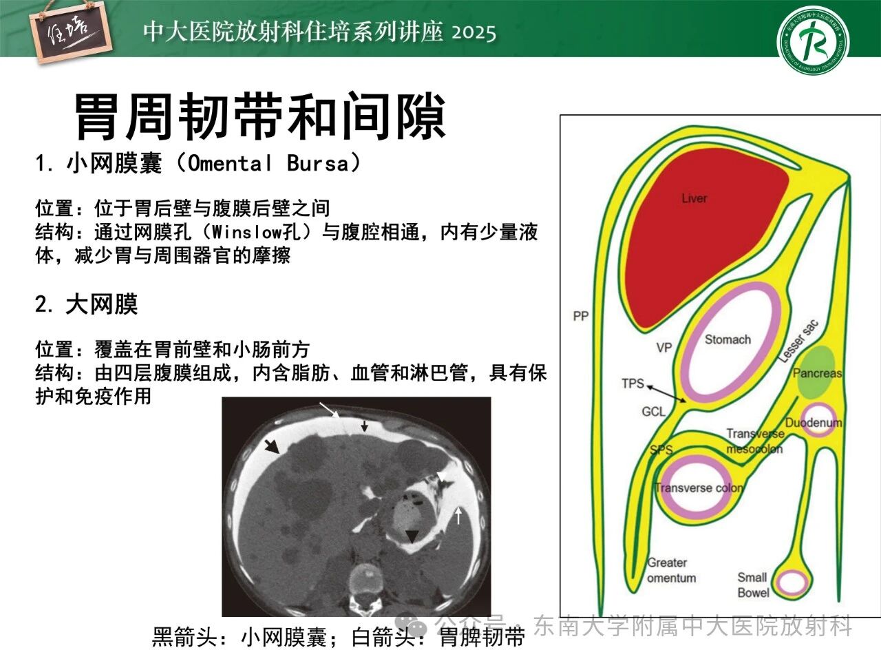 cdb1426936804e43a72ff45eae70bb41.jpg