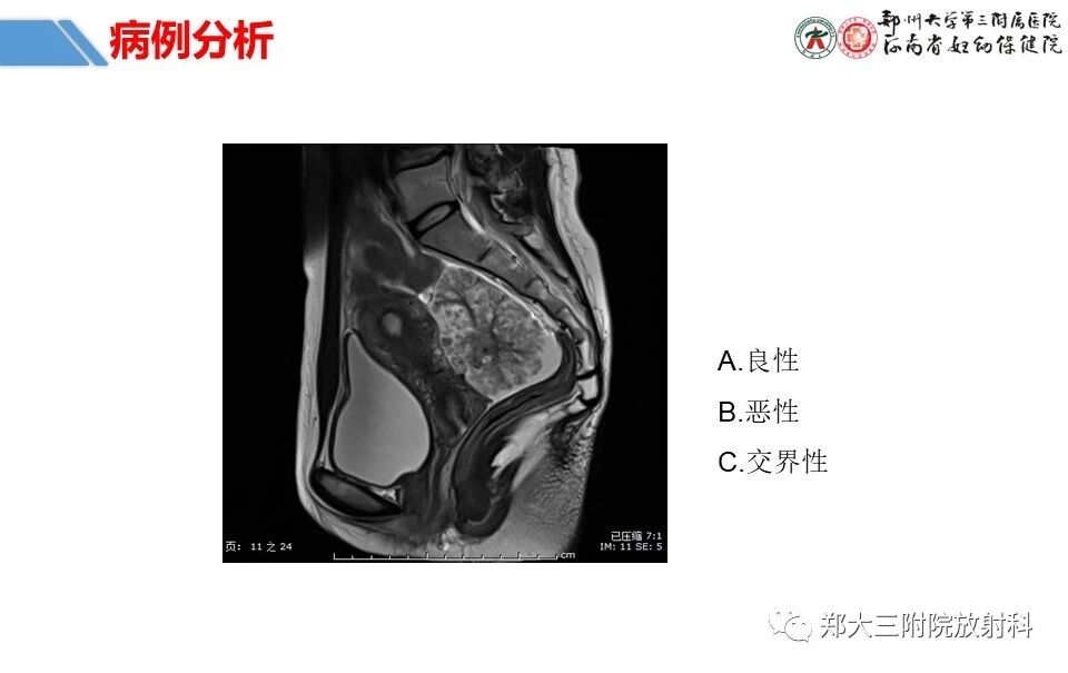 bdbdd9921afcf904658b5326b76bc198.jpg