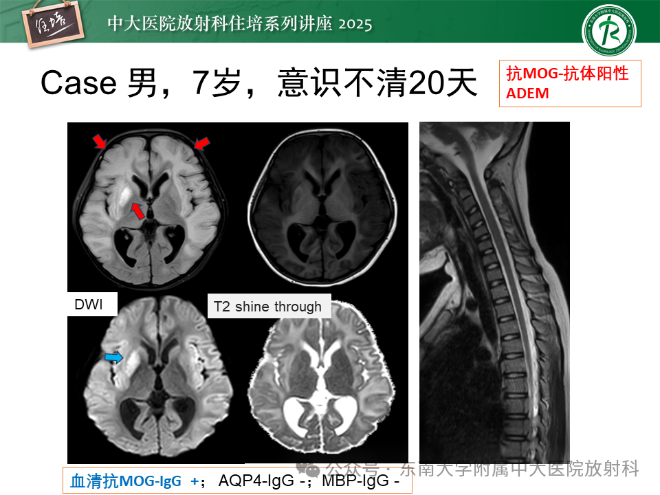 60400168cdec62f4550cbf1ee8feafc6.png