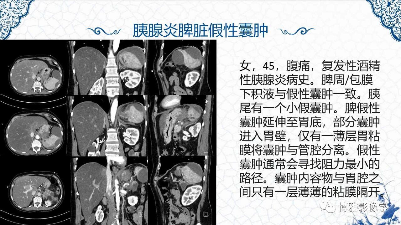 fc6b84a1631c6e956f9e1f7969c251a4.jpg