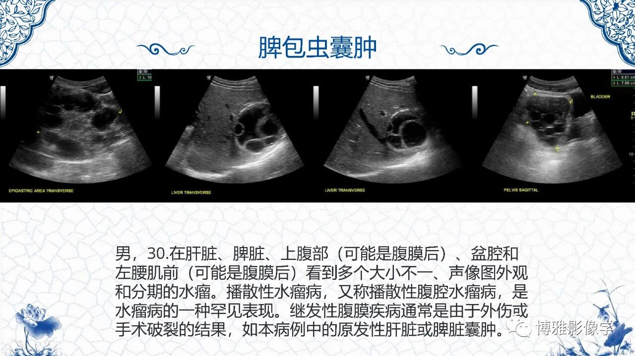 db5011444fa2f18f6be8e7acc7cb339b.jpg