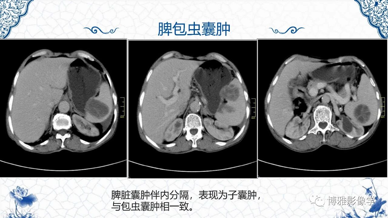 d811f299987704cfec18efac1893e191.jpg