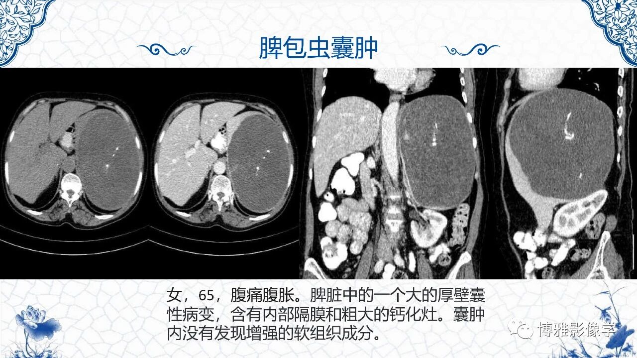f70ae381e0362ac0d7a74e26912ebebf.jpg