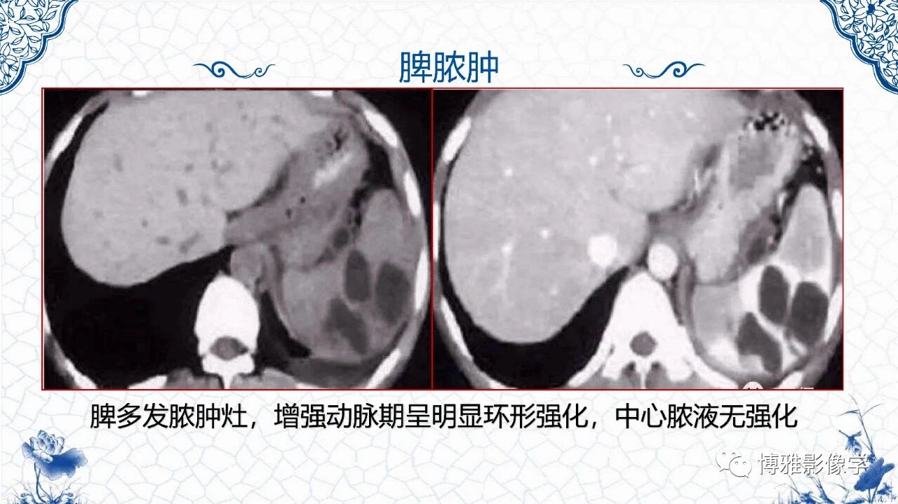 c8337fe3162d4198dc858704fb90afa7.jpg