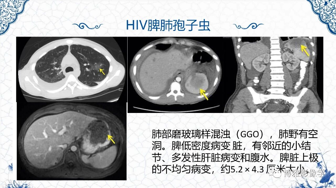 ff4cc3635996e9bf7f169cd3f6072bc0.jpg
