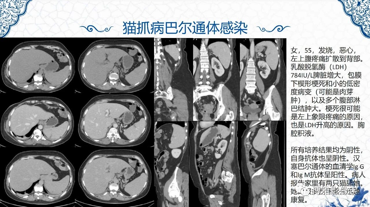 e50bceb41761e0d38aa510e94a25fcc9.jpg