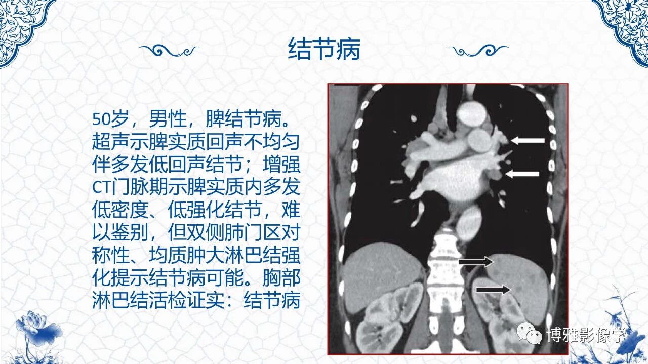 cd82cd46e3a8868ada53da11aef893bb.jpg