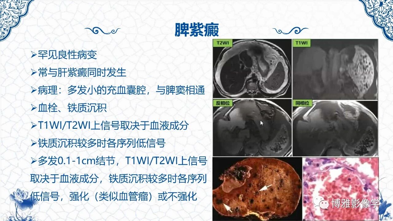 45ceba1077a289afe52fdfb1207003b9.jpg